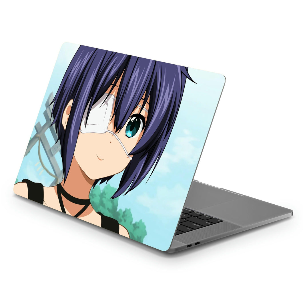 Love, Chunibyo & Other Delusions Rikka Takanashi  Macbook Skin