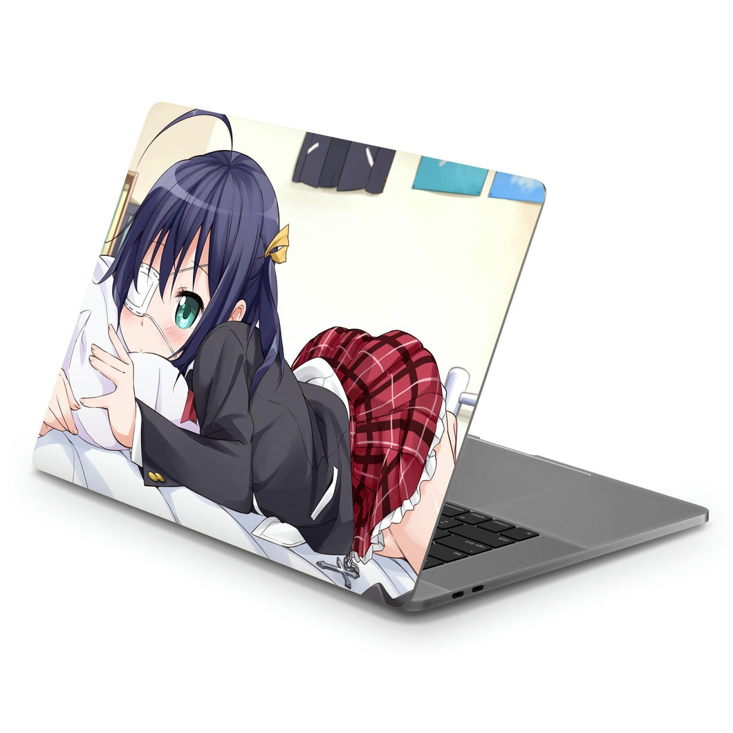Love, Chunibyo & Other Delusions Rikka Takanashi  Macbook Skin