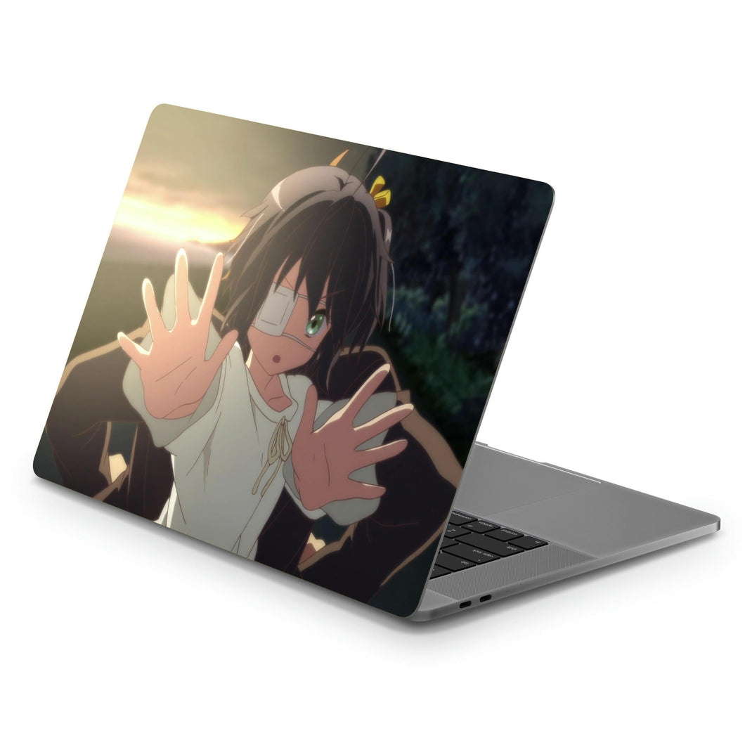 Love, Chunibyo & Other Delusions Rikka Takanashi  Macbook Skin